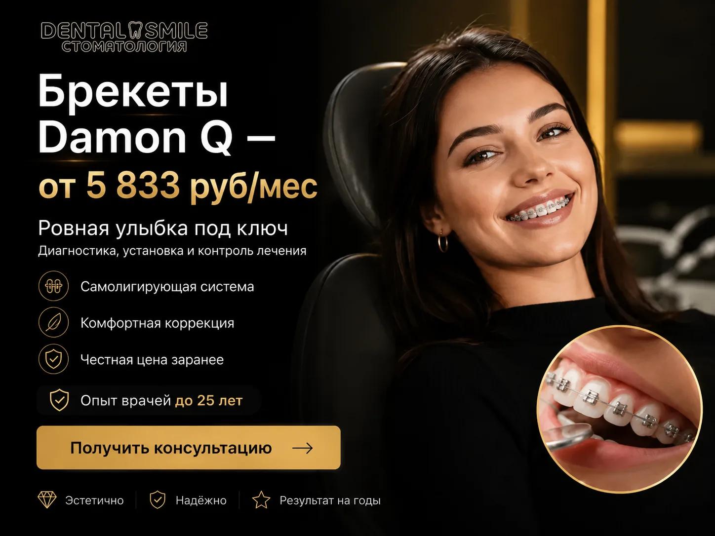 Брекеты Damon Q от 5 833 ₽/мес — акция, срок ограничен; «Дентал Смайл», Казань