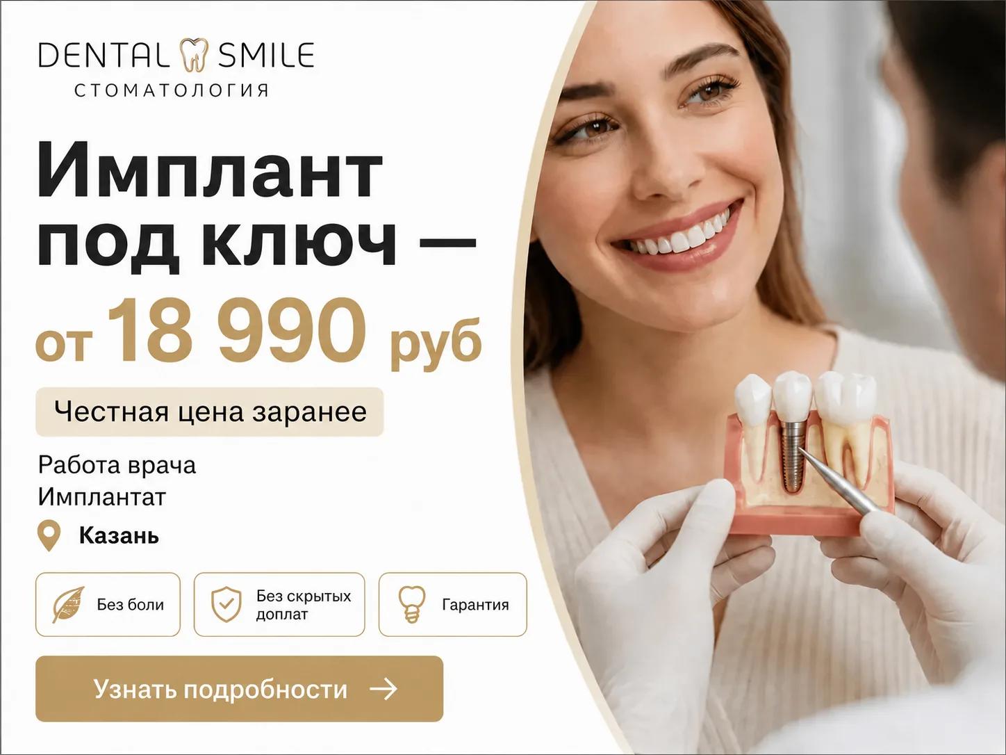 Имплант под ключ от 18 990 ₽ — акция, срок ограничен; «Дентал Смайл», Казань